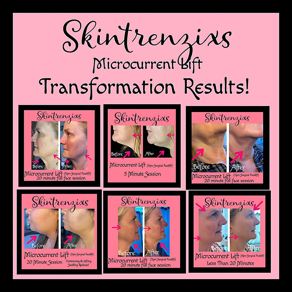 Skintrenzixs Microcurrent Lift